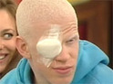 Darnell says his vision is worse