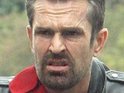 Rupert Everett confesses to Botox use