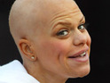 Jade Goody 'was pregnant with twins'