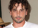 Skeet Ulrich for CBS medical drama