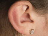 Woman 'has earlobe stitched to bottom'