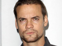 'ER' star Shane West injures face