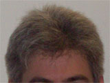 Cult Spy: Phobia Corner 2 - Haircuts