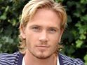 'Emmerdale' star finds sex scenes 'bizarre'